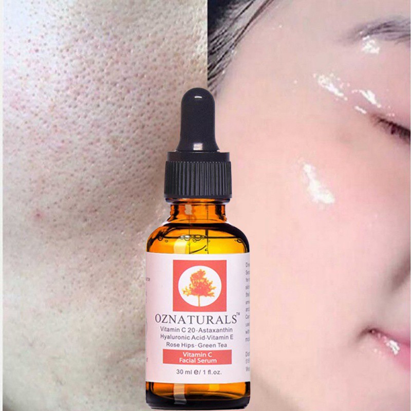 Top Serum Vitamin C tốt nhất được nhiều người khuyên dùng 14 Serum Vitamin C OZ Naturals