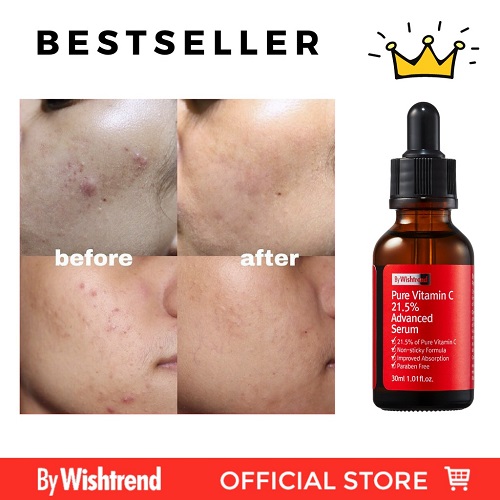 Review 6 serum Vitamin C “nổi đình đám” được nhiều người khuyên dùng 2025