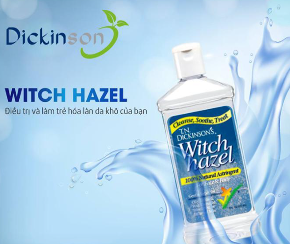 Review 3 toner Dickinson dự kiến “gây sốt” trên thị trường năm 2025