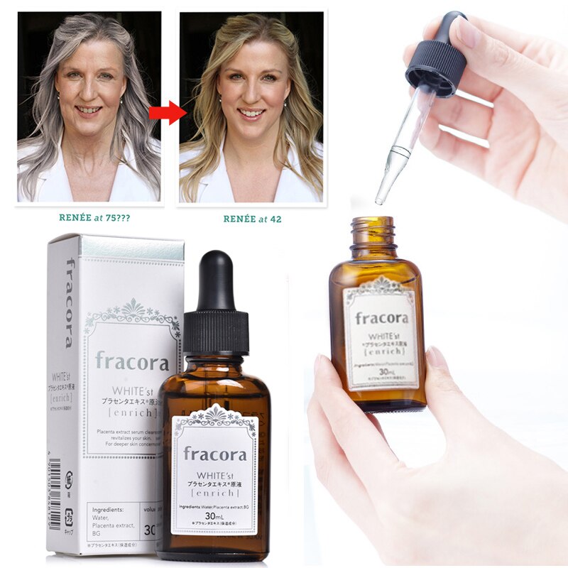 Review tất tần tật về serum Fracora. Top 7 sản phẩm đáng dùng nhất không nên bỏ lỡ! 2