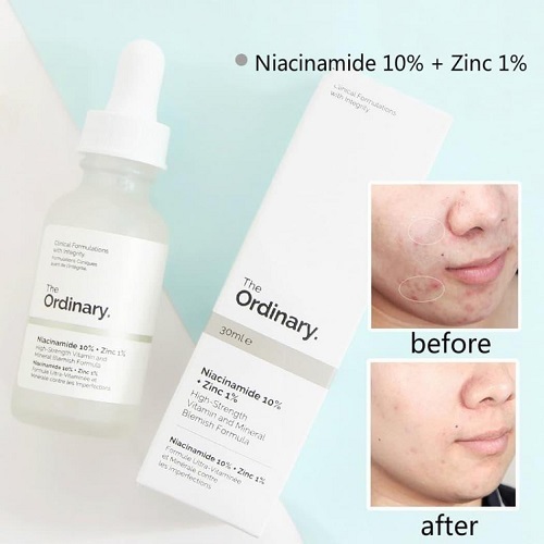 Review 12 serum trị mụn được đánh giá cao không được bỏ qua