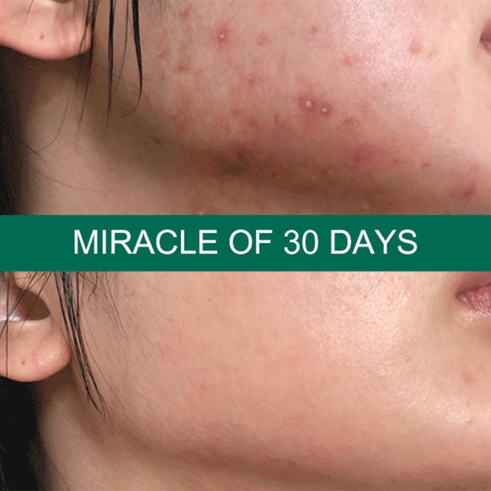 Review chi tiết 4 loại serum Some By Mi đình đám trên thị trường. Loại nào tốt nhất? 2