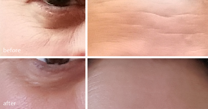 Review top 10 serum chống lão hoá tốt nhất, giúp níu kéo tuổi xuân cho phái đẹp 9