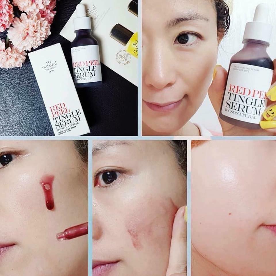 Review serum thay da sinh học Red Peel Tingle Serum có thực sự tốt như quảng cáo? 5