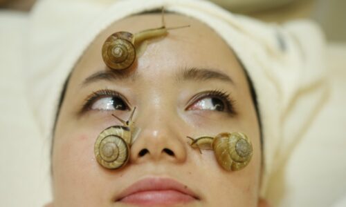 Review 6 kem trị nám ốc sên 2025 được giới "skincare" đánh giá cao