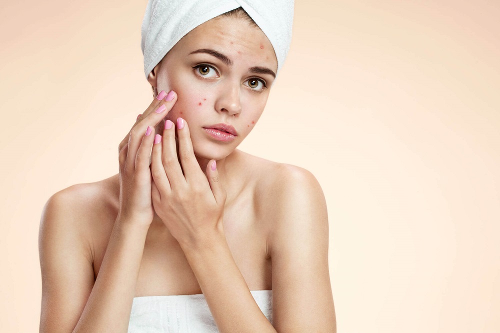 Đặc tính chống viêm của dầu chùm ngây còn giúp chống nổi mụn