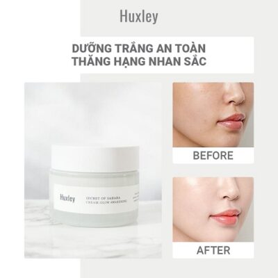Review 12 kem dưỡng trắng da được nhiều người mua 2025