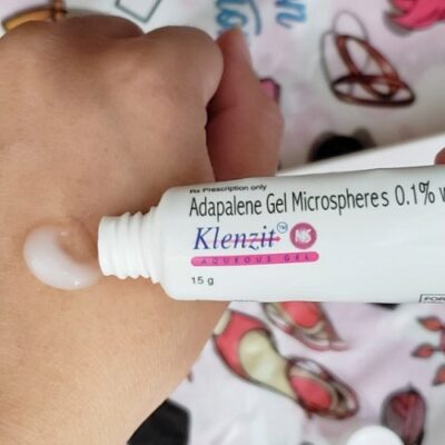 Review 10 kem trị mụn ẩn được săn lùng 2025