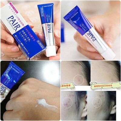 Review 10 kem trị mụn ẩn được săn lùng 2025