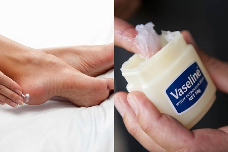 Cách trị nứt gót chân hiệu quả bằng Vaseline