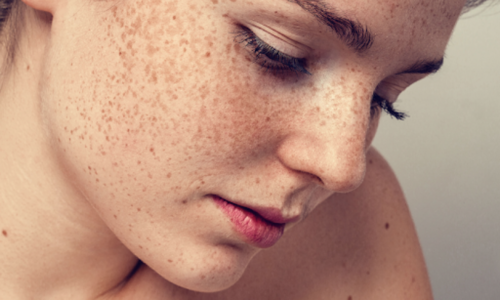 Review 5 kem trị nám được giới skincare đánh giá cao 2025