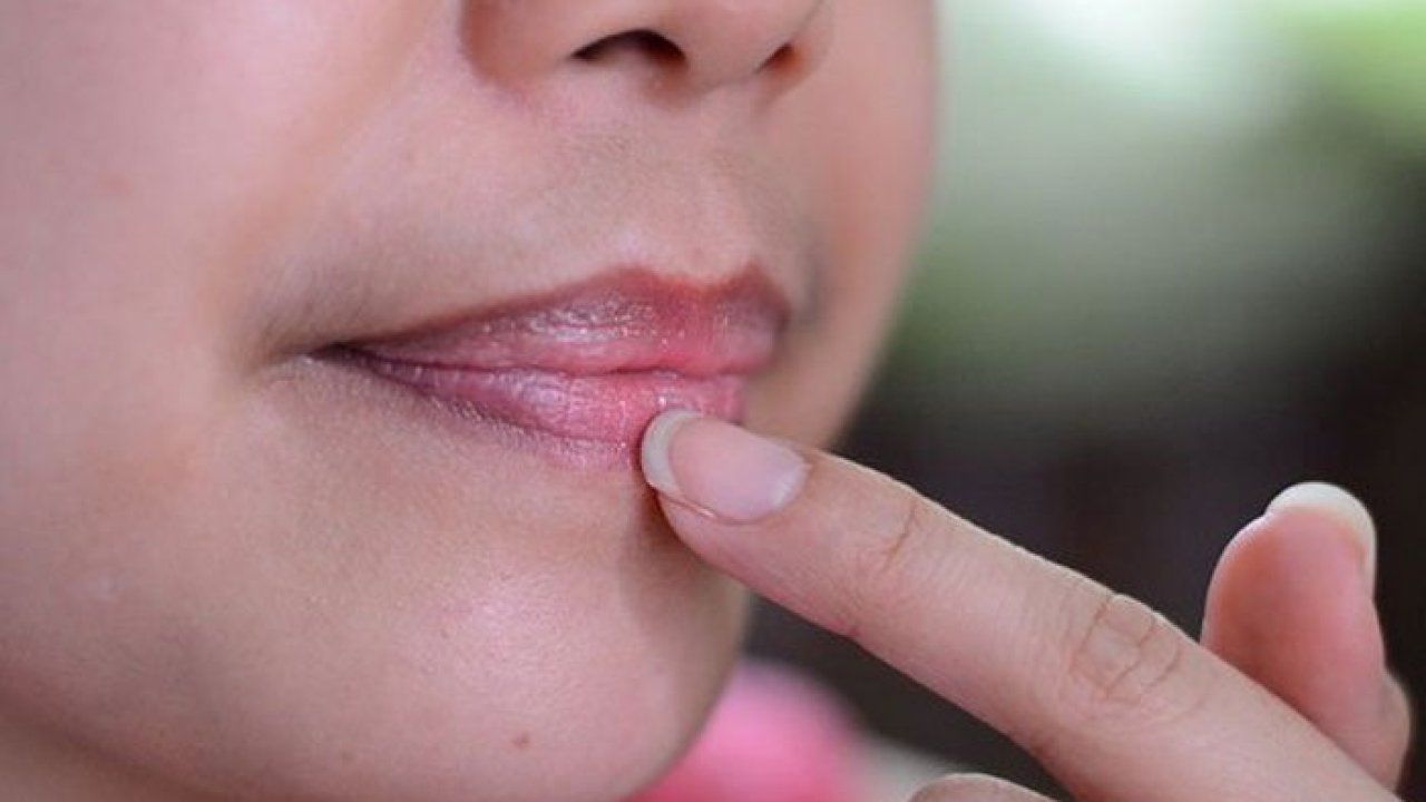 Nguyên nhân nào gây ra thâm môi?