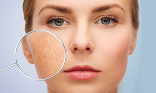 Review 7 loại serum se khít lỗ chân lông được chị em tìm mua nhiều nhất 2025