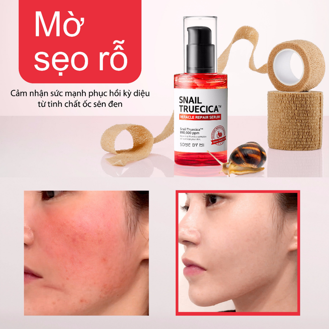 Review 11 serum trị sẹo rỗ hiệu quả nhất mọi cô nàng nên dùng