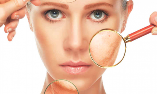 Review 10 thuốc trị sẹo thâm được tìm mua nhiều nhất 2025
