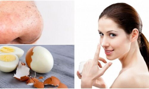 8 cách trị mụn bằng trứng gà quá dễ ai cũng làm được