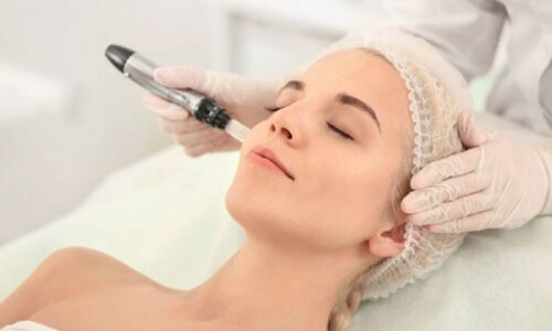 5 cách trị vết thâm sau khi bắn laser và hướng dẫn chăm sóc da