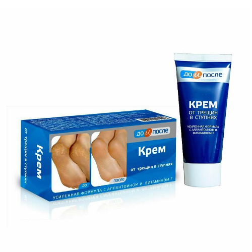 Review 10 kem trị nứt gót chân tốt đáng sử dụng nhất 2025