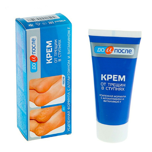 Review 10 kem trị nứt gót chân tốt đáng sử dụng nhất 2025