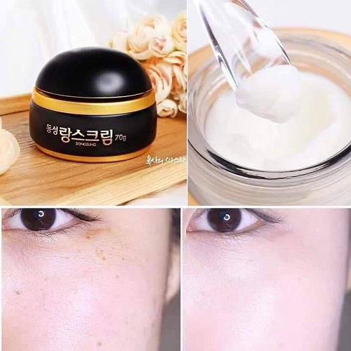 Review 12 kem trị tàn nhang được chuyên gia đánh giá cao 2025