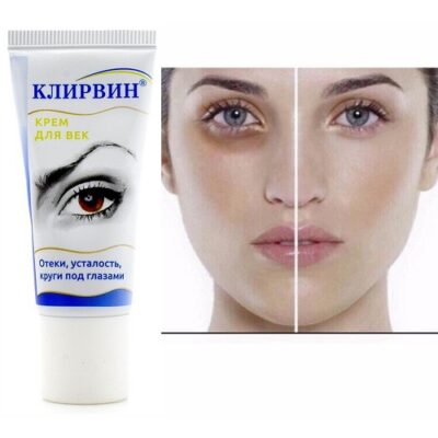 Review 10 kem trị thâm mắt hiệu quả bán chạy nhất 2025