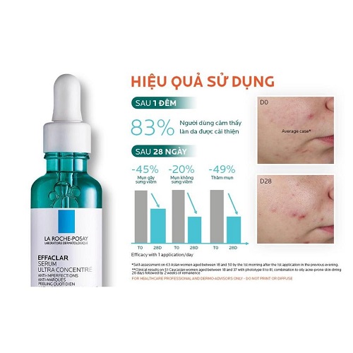 Review 7 serum trị mụn ẩn được “beauty blogger” khen ngợi 2025