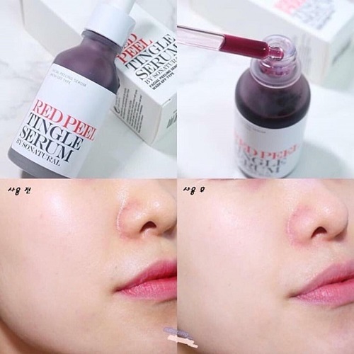Review 8 serum Hàn Quốc được chị em tin dùng 2025
