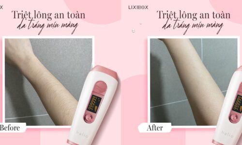 Máy triệt lông Halio IPL có thật sự hiệu quả như lời đồn?