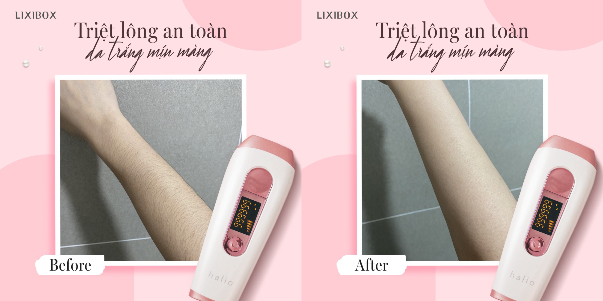 Máy triệt lông Halio IPL có thật sự hiệu quả như lời đồn? 5